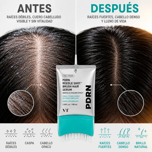 Dermyl Anticaida · Método Doble Raíz