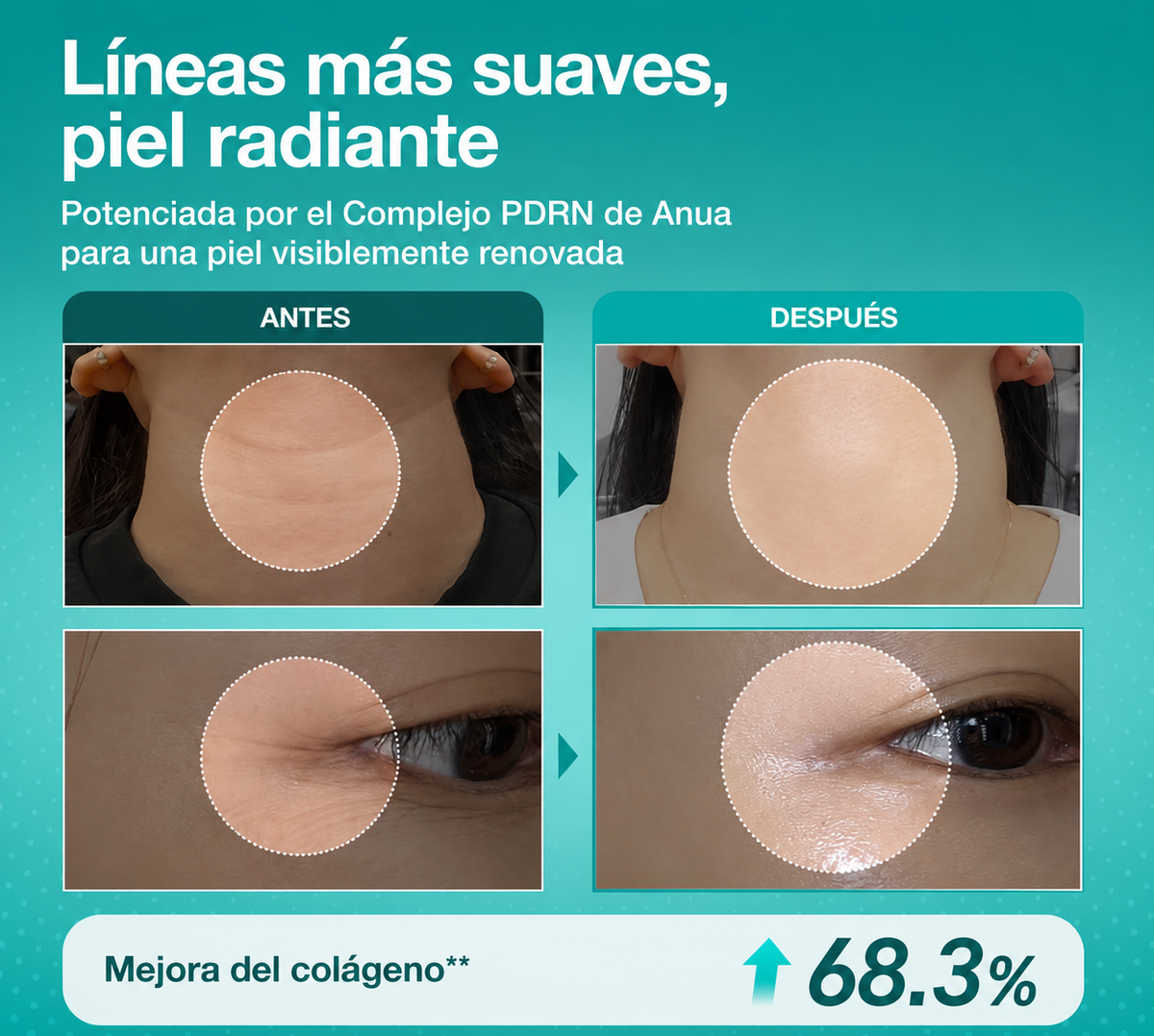 Dermyl Anua con PDRN y ácido hialurónico.