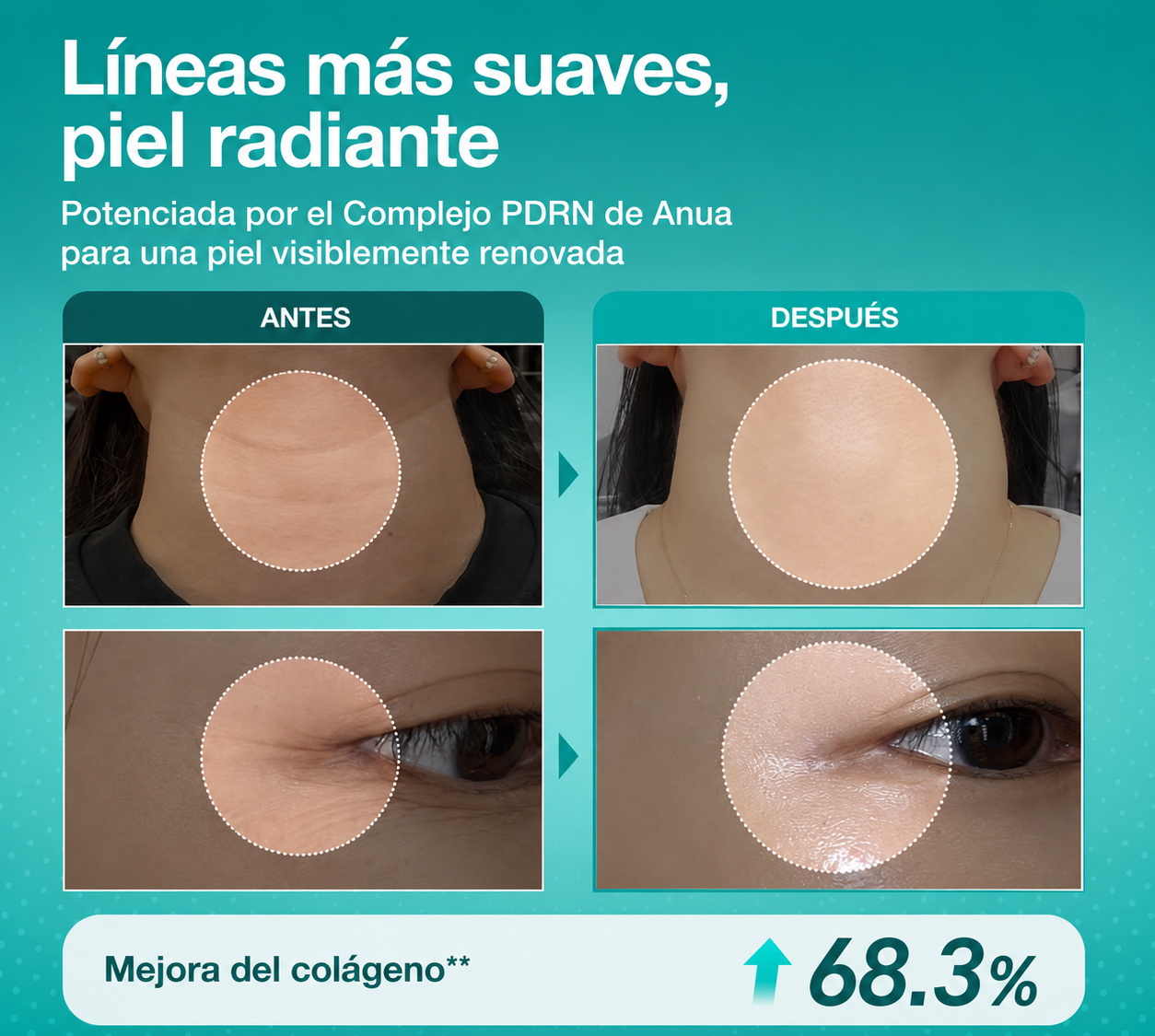 Dermyl Anua con PDRN y ácido hialurónico.
